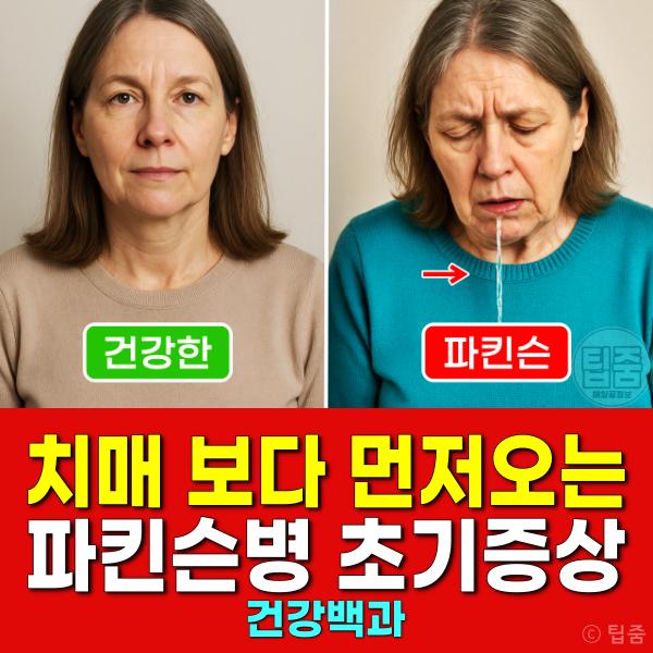 치매 파킨슨병 초기증상