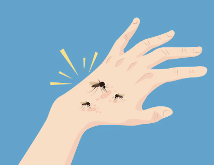 몸이 가려운 이유 34