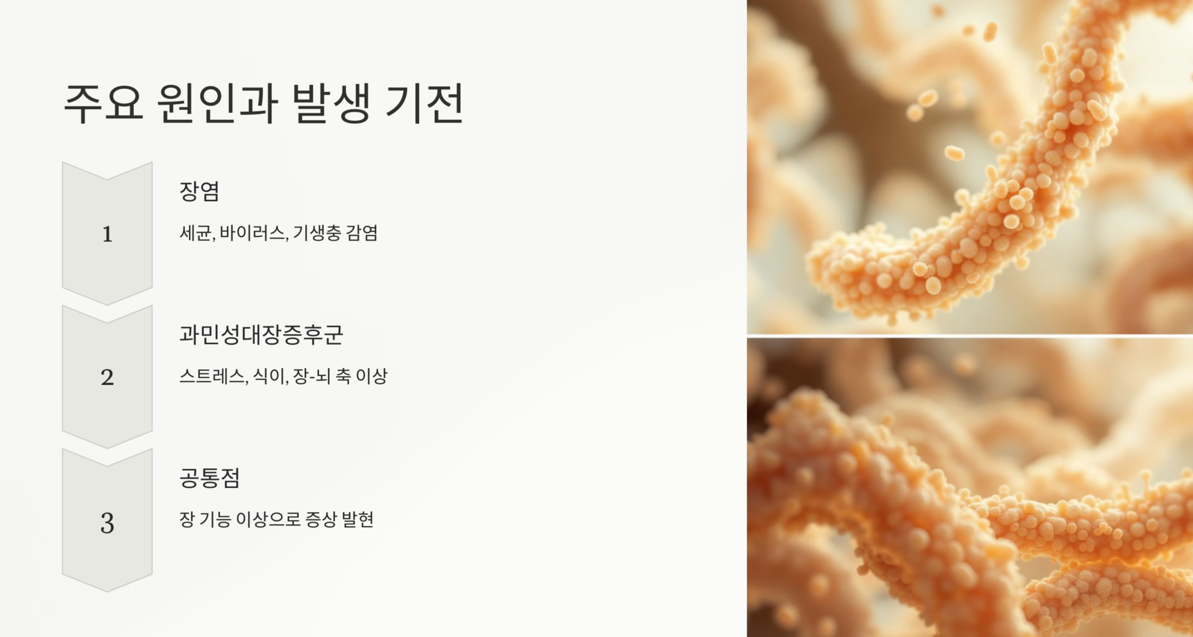 주요 원인 사진