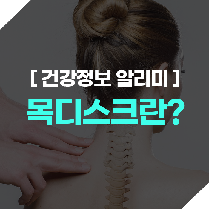 목디스크란? 목과 어깨 통증 원인은!