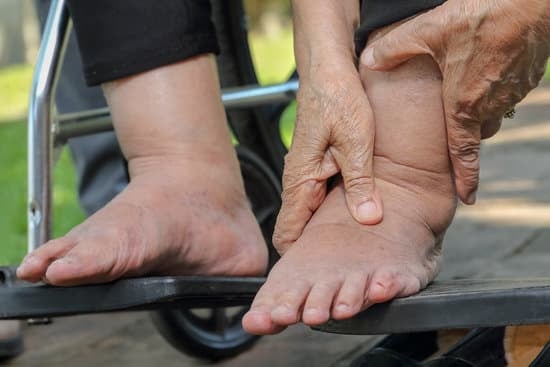 Ankle Fusion (발목 유합술) – 만성 발목 통증의 근본적 해결 방법