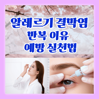 알레르기 결막염이 반복되는 이유와 알레르기 결막염 예방 실천법