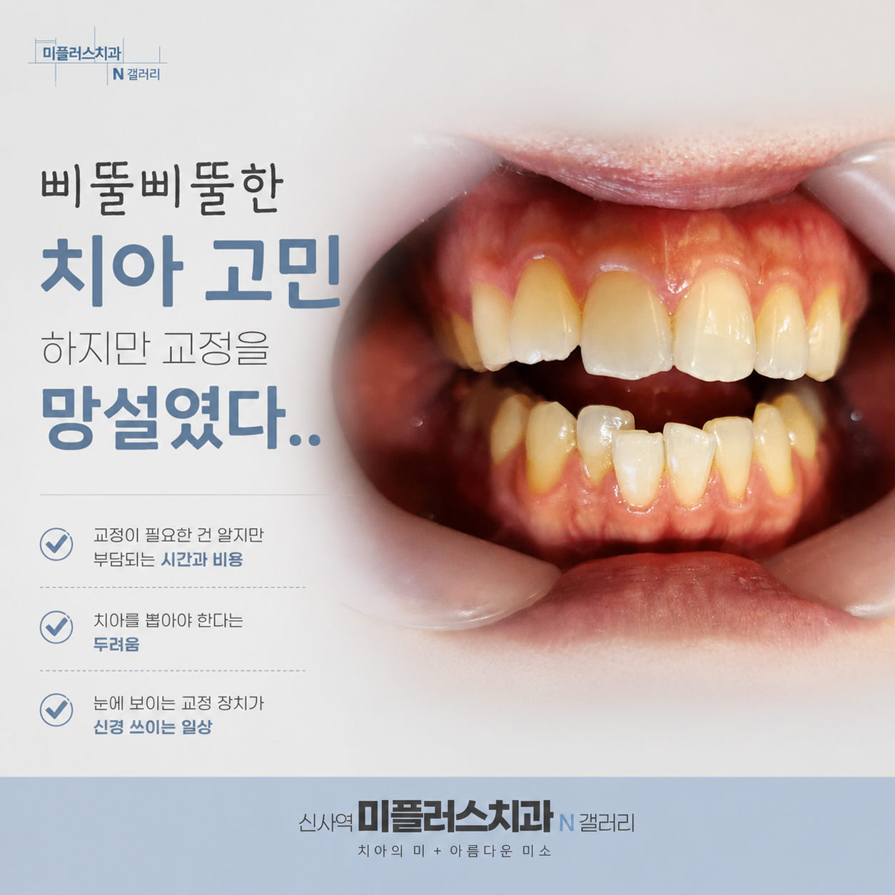 삐뚤어진 덧니와 부정교합 치아 배열, 설측교정 및 치아교정 상담 안내 이미지