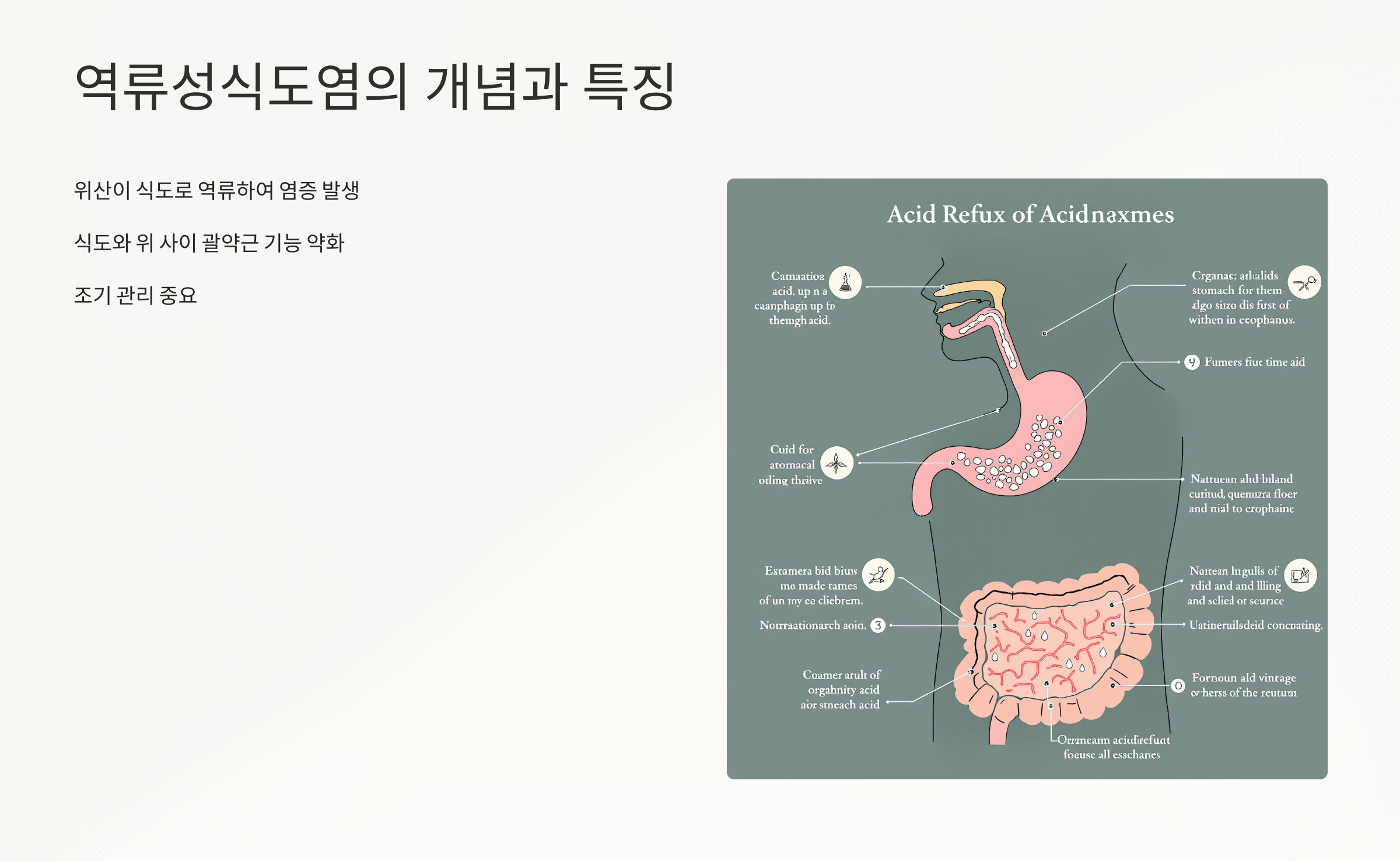 역류성식도염 증상 사진입니다.