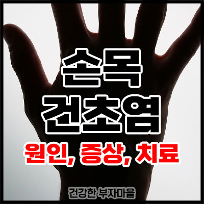 손목 건초염