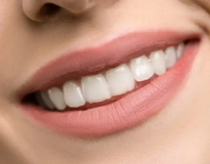 구내염 빨리 낫는법