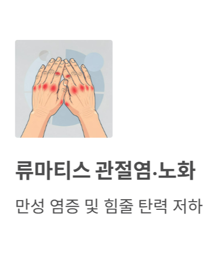 방아쇠 수지 증후군