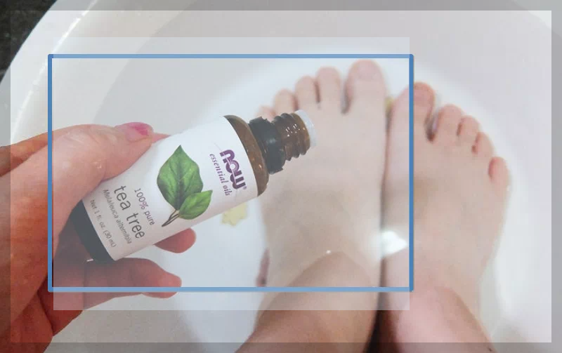 족용시 티트리 오일