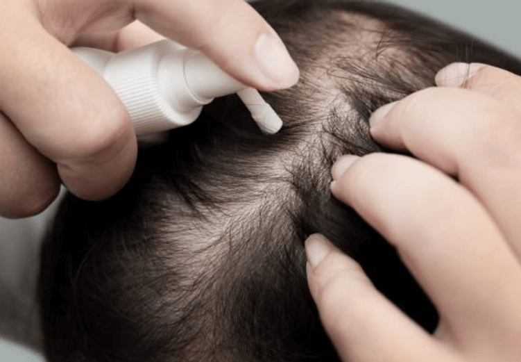 머리카락 빨리 자라게 하는 방법