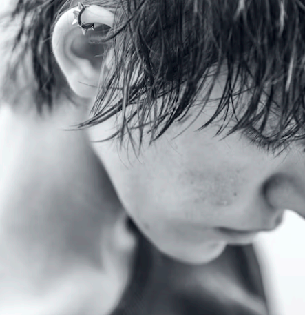 돌발성 난청 원인 