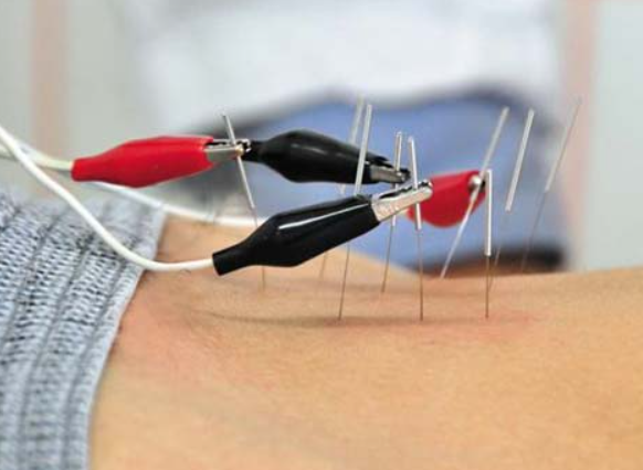 전침치료중인 이미지