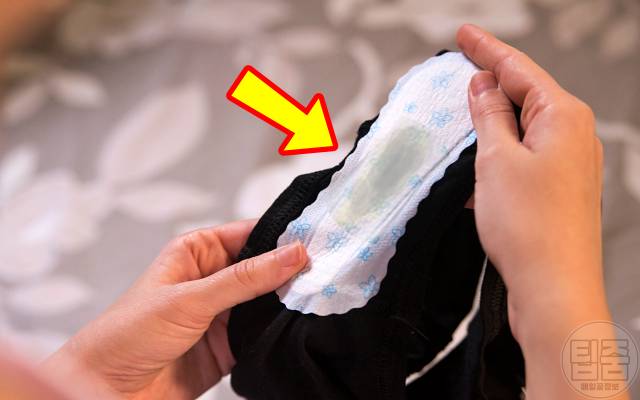 질염 증상 회색냉,냉이덩어리로나올때,질염치료제