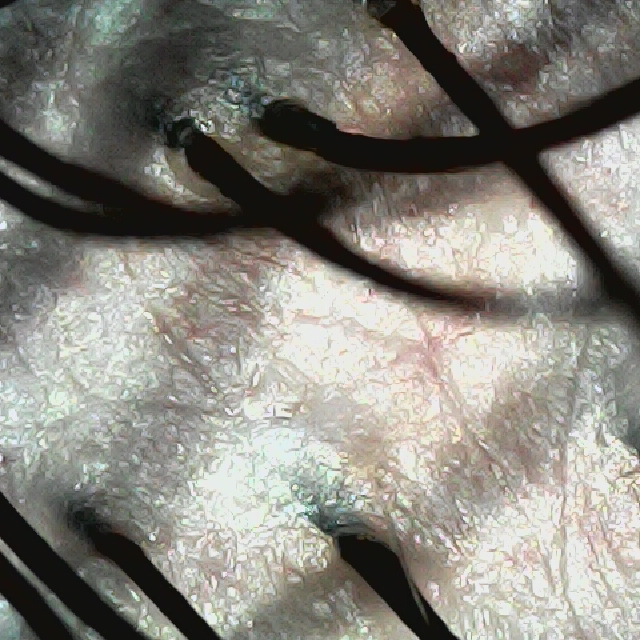 탈모 극복 프로젝트 - 뒷머리 두피 모습이다.