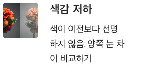 황반변성 초기 색감저하