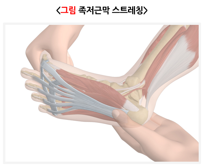 족저근막염 스트레칭 치료방법