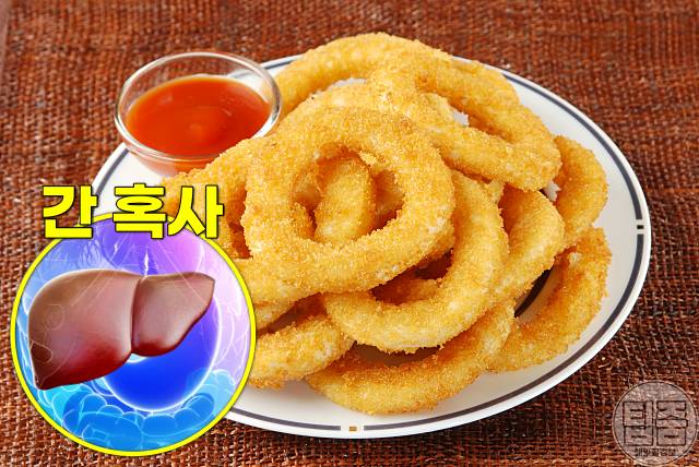 피부노화 원인 식품 피부염증 원인 음식