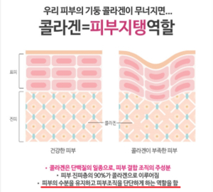 피부콜라겐