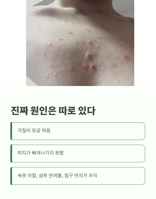 진짜 원인은 따로 있다