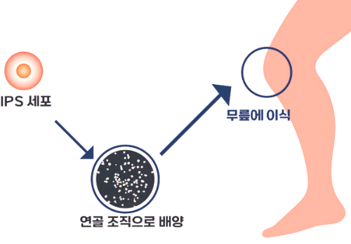 콘드로이친 효능 부작용