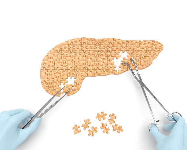 췌장암 신약 FDA 패스트 트랙 지정