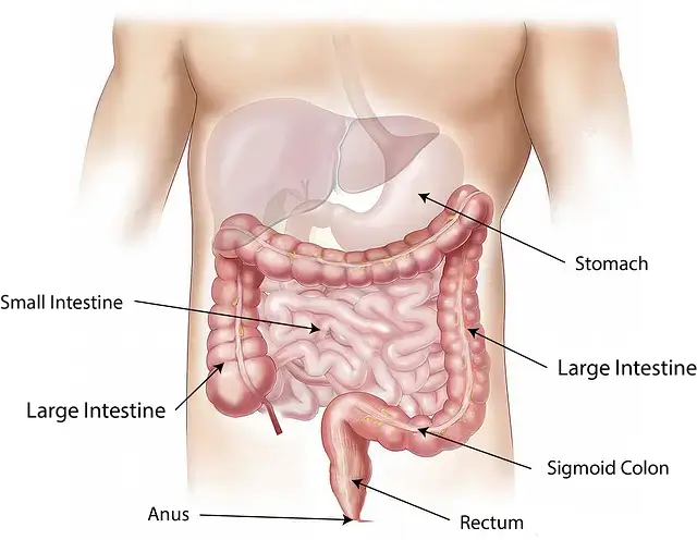 대장암 증상 좋은 음식