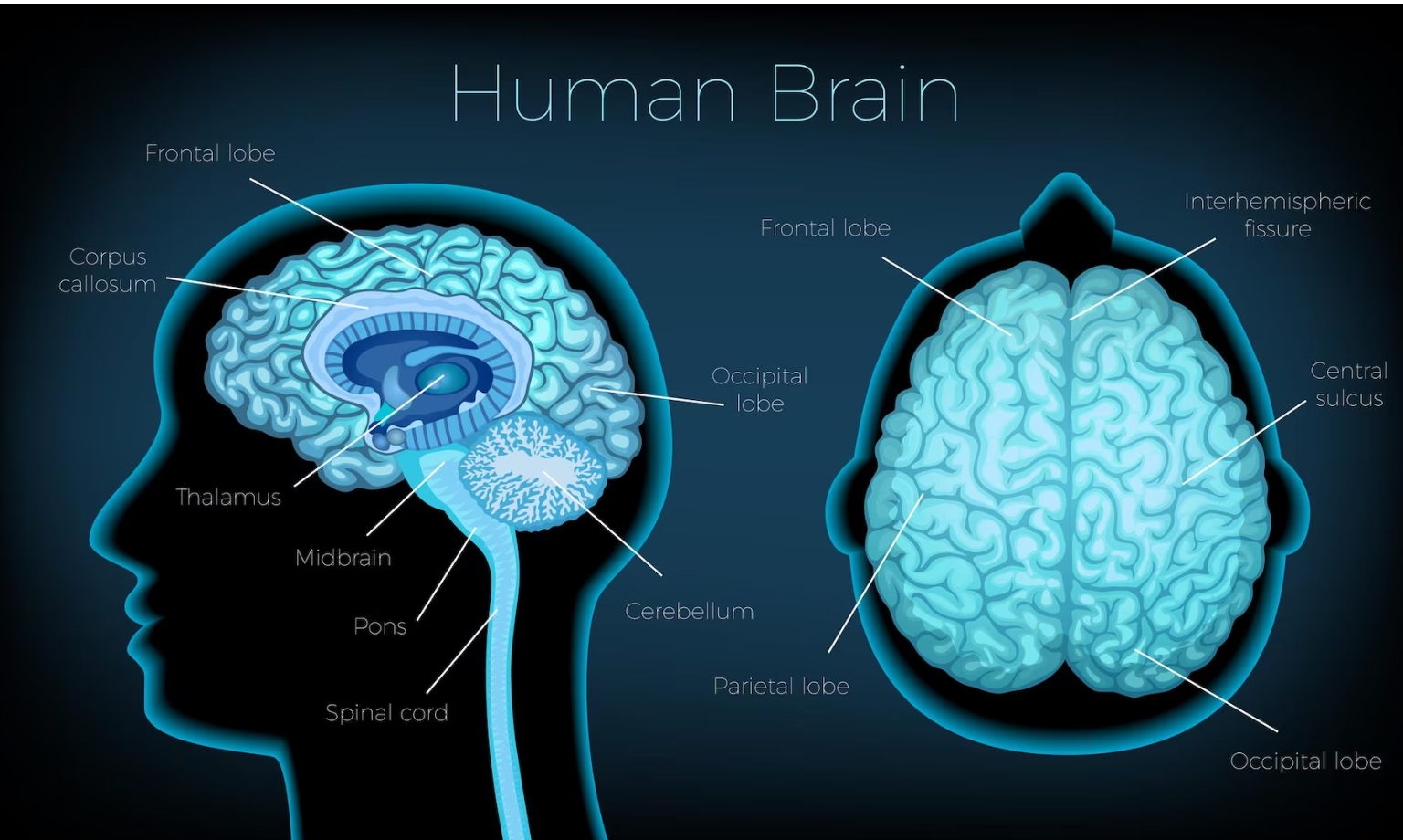 치매에 좋은 우리나라음식 글에대한뇌사진