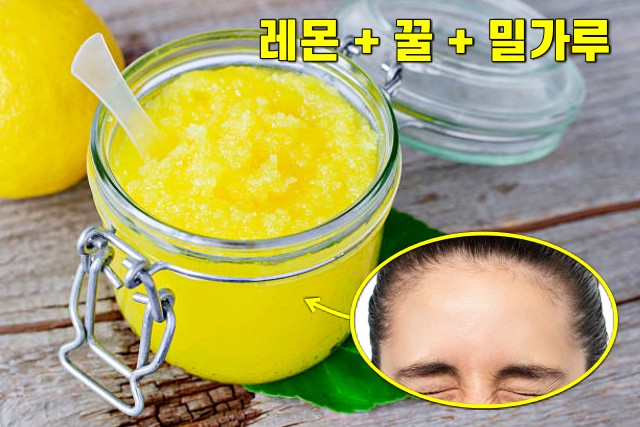 이마 주름 없애는법, 이마주름 없애는 자연팩,레몬팩 효능,뷰티 팁줌