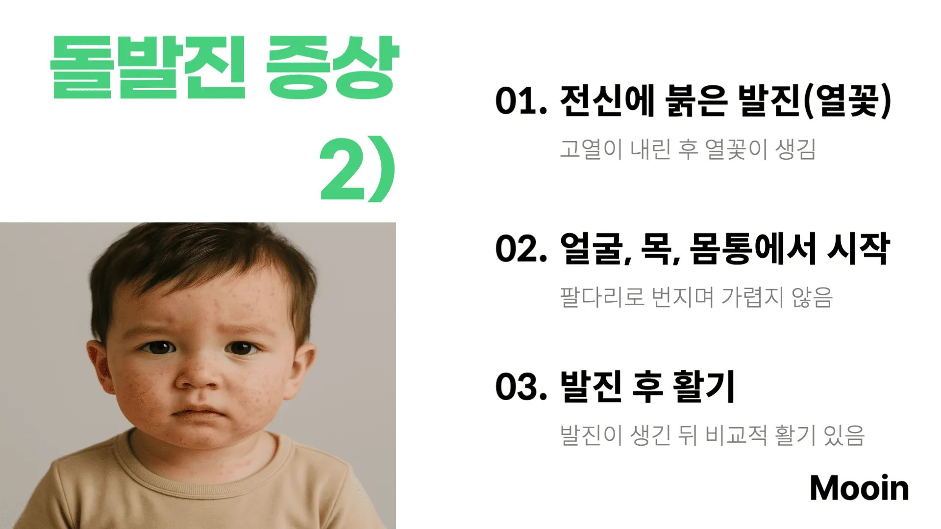 돌발진 증상