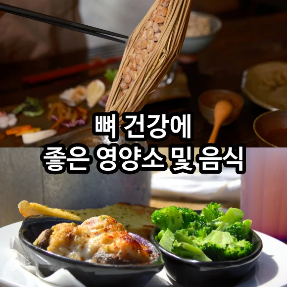 골다공증 골감소증 예방 뼈 건강에 좋은 영양소 및 음식