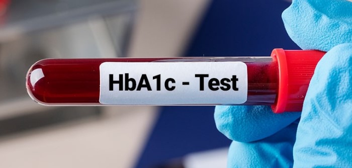 혈당 정상수치 HbA1c