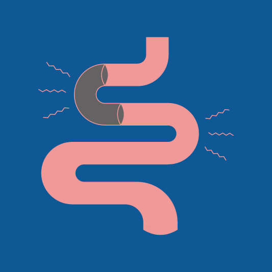 변비-이미지-예시