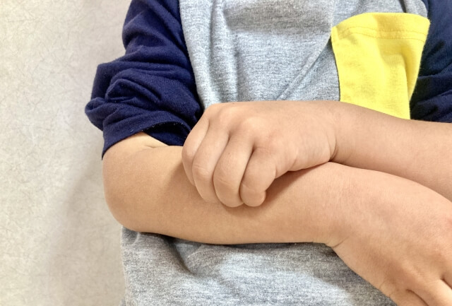 아토피피부염의 근본 원인과 효과적인 치료 방법