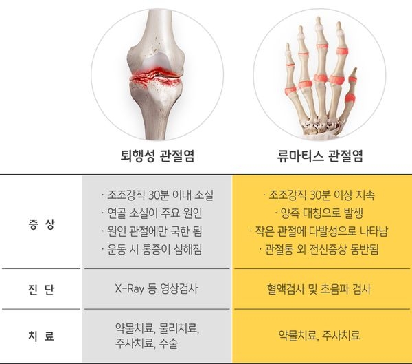 퇴행성 관절염
