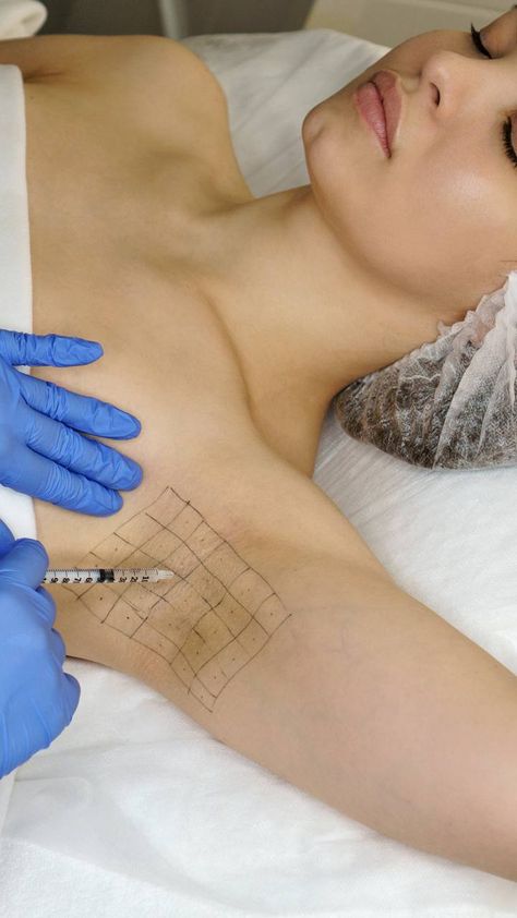 암내 없애는 방법 암내 제거 수술 겨드랑이 암내 원인 증상 어떤냄새