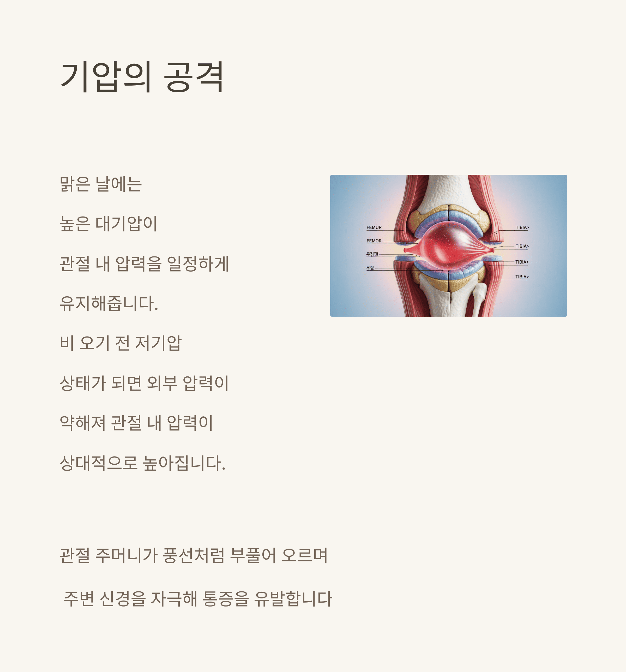 내 무릎은 기상청