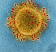 대상포진 초기증상 원인 예방 관리법