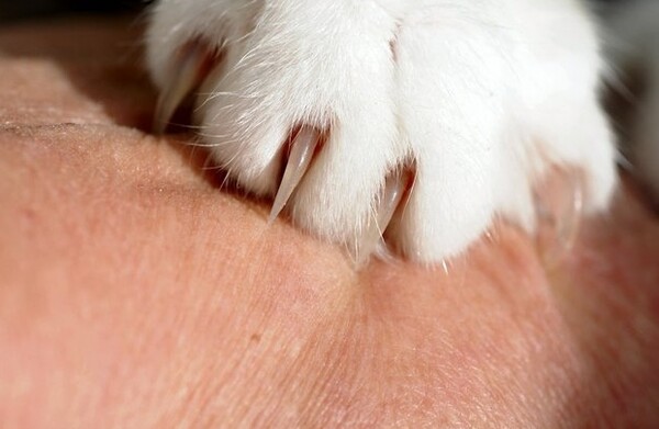 파상풍 주사 가격&amp;#44; 예방접종 초기증상 치료법