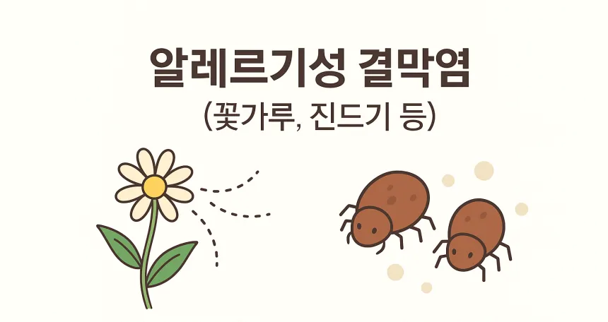 알레르기성 결막염