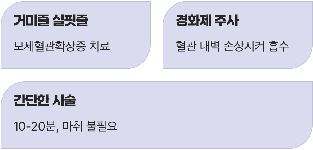 거미줄 같은 실핏줄, 주사로 간단하게