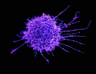 전립선 비대증 증상 치료 수술비용