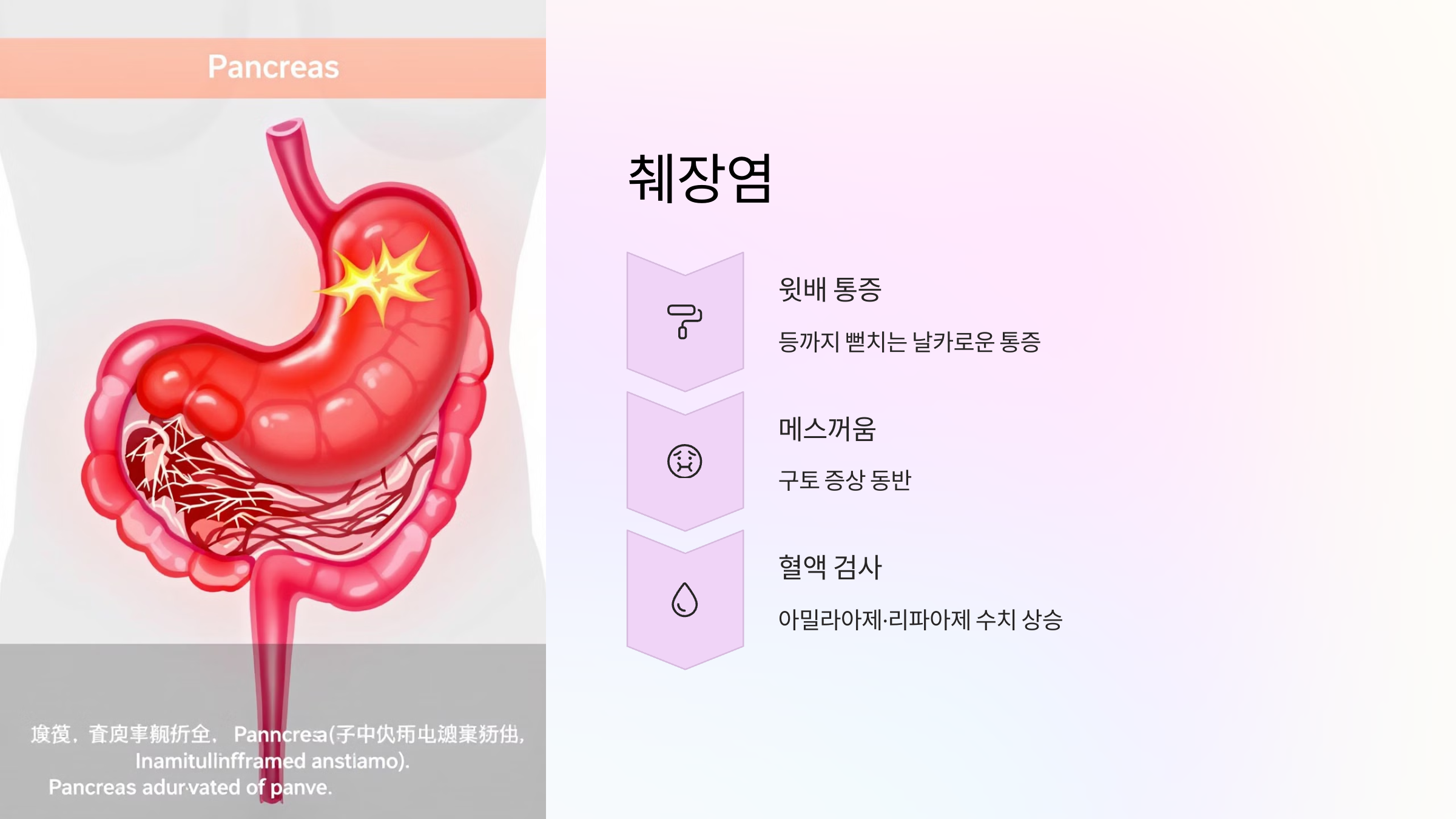 췌장염