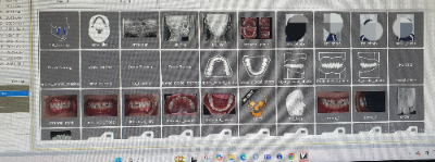 교정 진단에 필요한 엑스레이와 사진