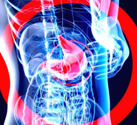 위암 : 위장의 위치