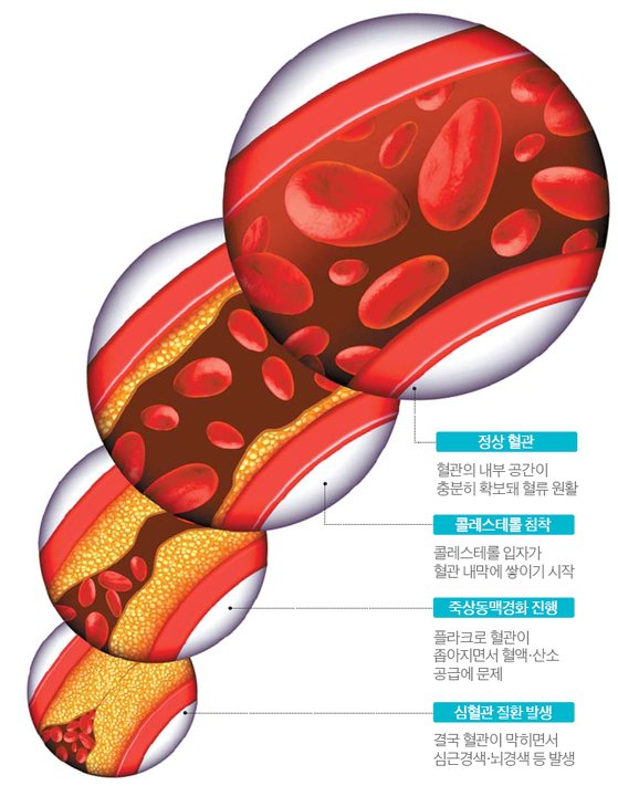콜레스테롤