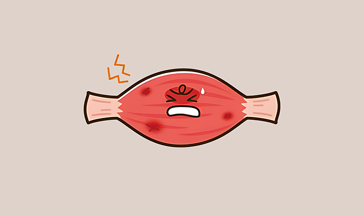 염증이-생긴-근육의-모습