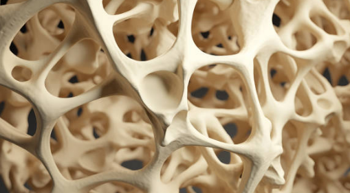 골다공증 증상, 수치, 골다공증에 좋은 음식 총정리 (2024ver)