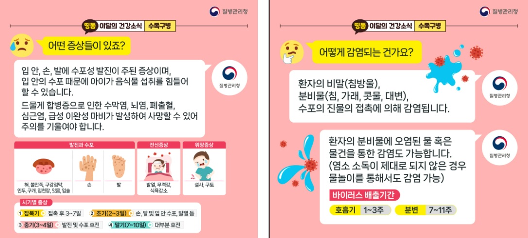 수족구병