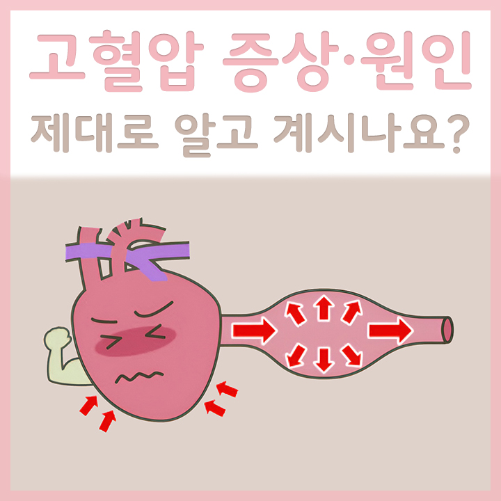 고혈압-증상이-있는-혈관의-모습