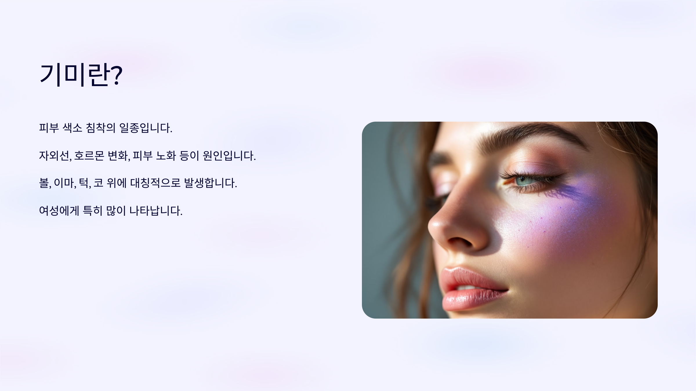 기미 치료 기미란?