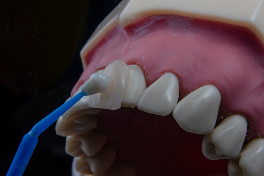 Implant